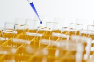 testai_laboratorijoje_sxc (c) Stock.xchng archyvo nuotr.